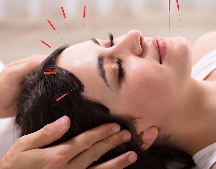 Benefits Of Acupuncture